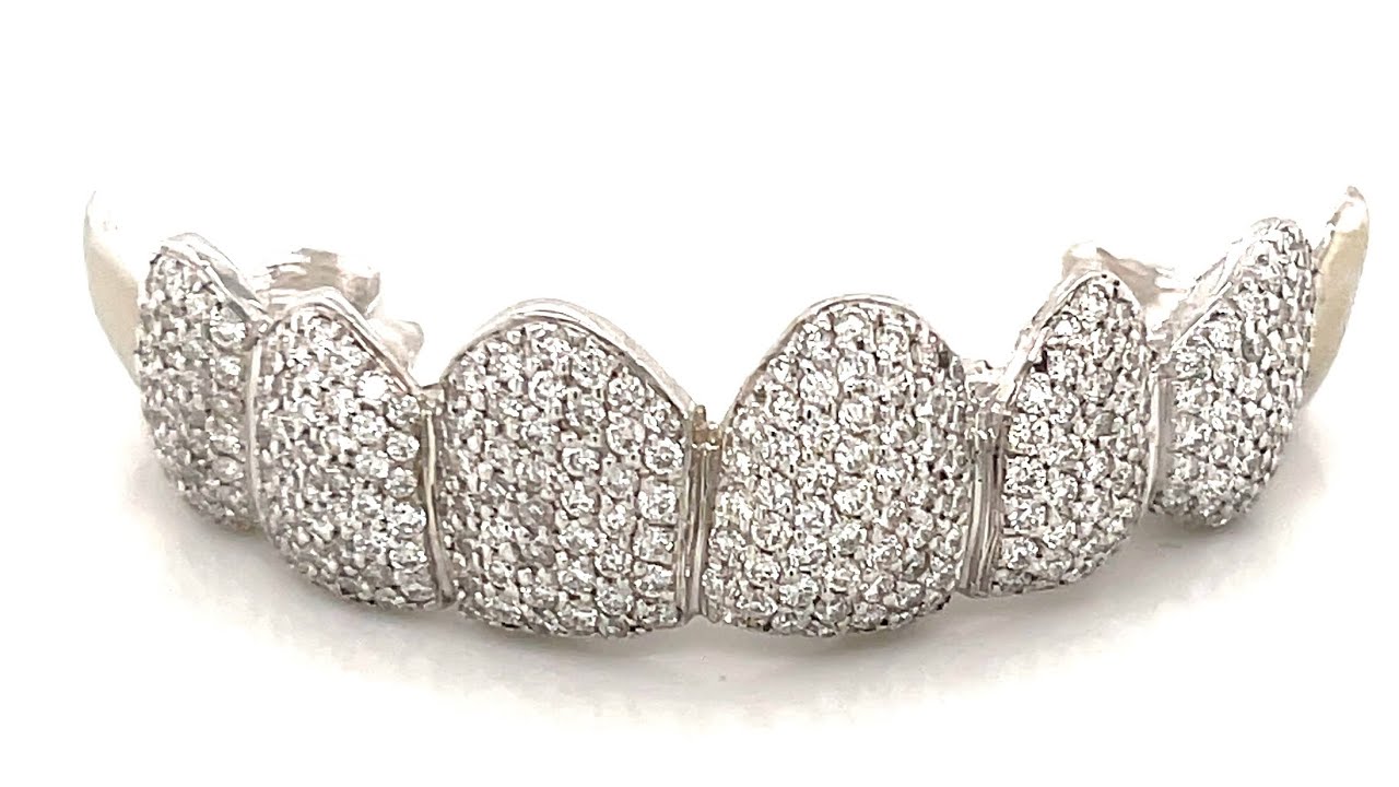 8pc Diamond Grillz in White Gold is different. SeattleGoldGrills ships