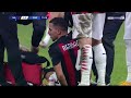 Bennacer Blessure Aujourd'hui Youtube جرح إسماعيل بن ناصر اليوم