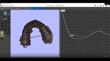 CS 3600 Tracking Tooth Wear
