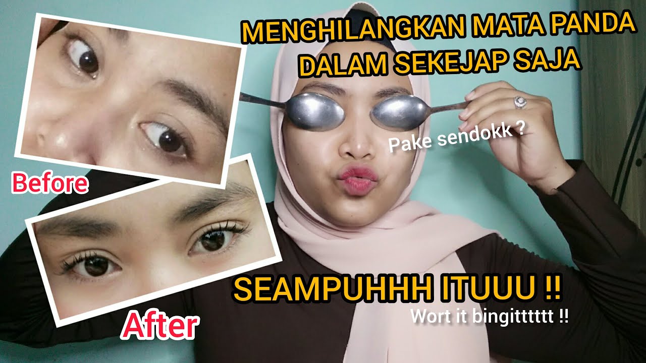 Pake sendok untuk menghilangkan mata panda, emang bisaaa