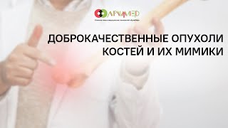 Доброкачественные опухоли костей и их мимики