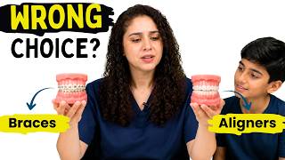 Invisible Aligners vs Braces: What’s Best for Your Child? Orthodontist Explains
