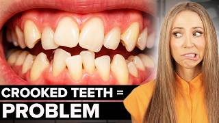 Why Dentists Care About Straight Teeth