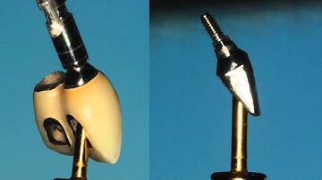 Curved implant abutment and curved driver