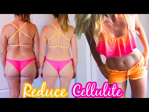 Video: Goodbye Cellulite