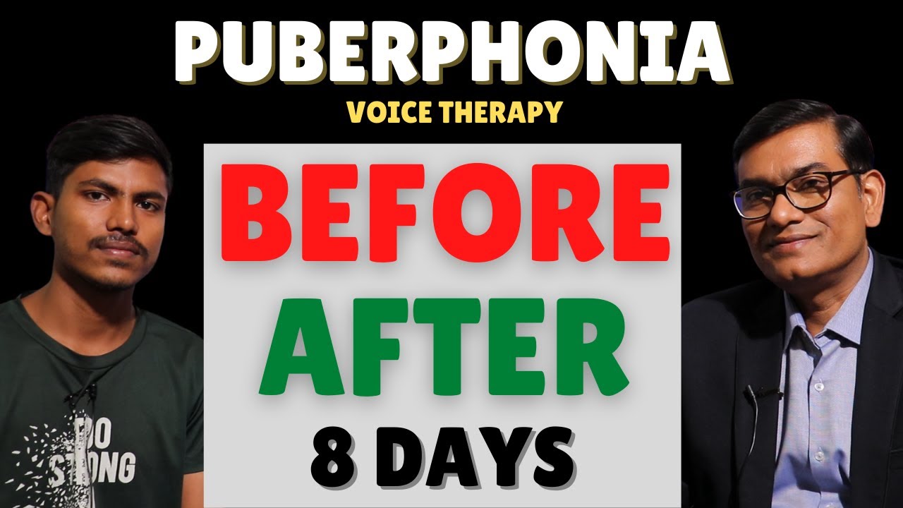 BeforeAfter Puberphonia Voice Therapy By SLP Sanjay Kumar Within