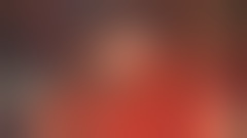 Microdiscectomy - Video 1 Finding Lumbar disc fragment