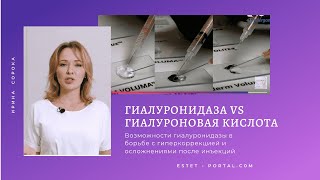 Как гиалуронидаза помогает справиться с гиперкоррекцией гиалуроновой кислотой | estet-portal.com