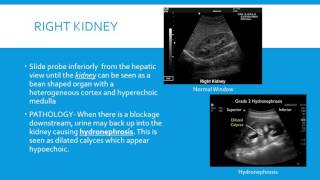 Basic Pulmonary and Abdominal Ultrasound