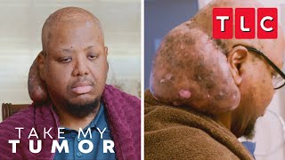 Arlin's Massive Neck Tumor Embarrasses Him | Take My Tumor | TLC