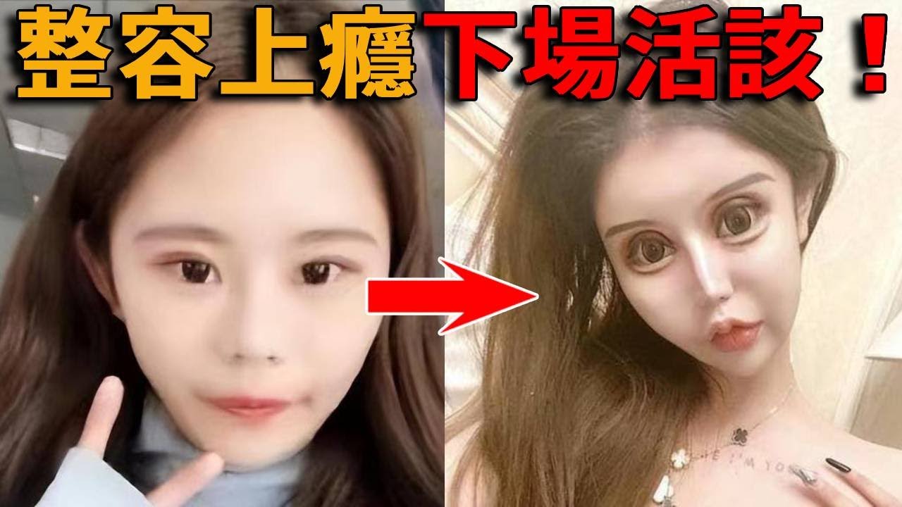 網紅整容上癮！ 15歲動刀上百次、花十億換臉成baby，結果全整成怪物臉，被網友揭穿只是在騙流量，下場真是活該！