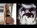 Bauch einer Schwangeren wuchs immer weiter. Beim Ultraschall entdeckte der Arzt etwas Seltsames