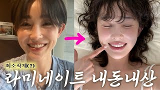 최소 삭제라ㅁㅕ..? 내돈내산 가짜치아🦷 팩폭 리뷰🥶(잇몸성형, 가격, 부작용, 장단점..)