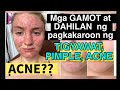 MGA NATURAL AT HOME REMEDIES NA GAMOT SA TIGYAWAT,PIMPLE ACNE, ano ang dahilan o sanhi ng TIGYAWAT,