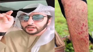 هادي بن شملان |صلالة كلها بـعوض!! 🇦🇪🇴🇲🌴