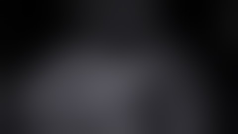 Twin pregnancy atypical case. probably TRAP sequence. DD: hydrops.