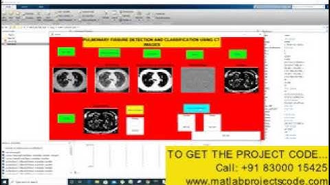 Pulmonary fissure detection and classification using CT images