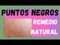 Cómo limpiar PUNTOS NEGROS de la CARA con remedios NATURALES  remedio de cosmética natural fácil