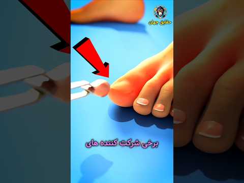 کشیدن ناخن قبل دوی مارتن