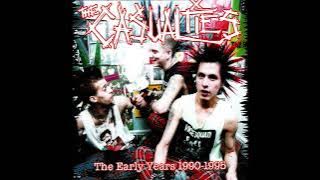 THE CASUALTIES - THE EARLY YEARS 1990-1995