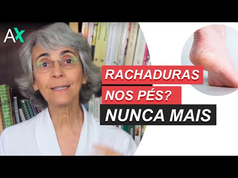 Vídeo: Calcanhares Rachados E Deficiência De Vitamina: Existe Uma Conexão?