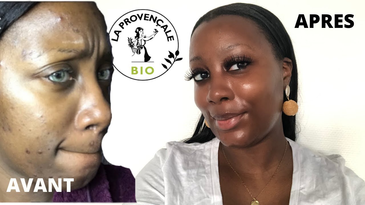 COMMENT AVOIR UNE BELLE PEAU FERME | ANTI ACNÉ | DyDy xoxo #bellepeau #
