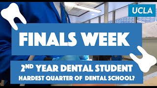 Hardest Quarter in Dental School? FINALS WEEK @ UCLA