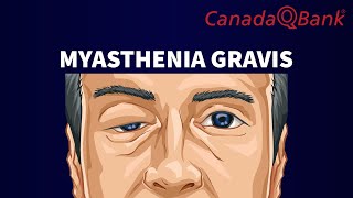 Myasthenia Gravis