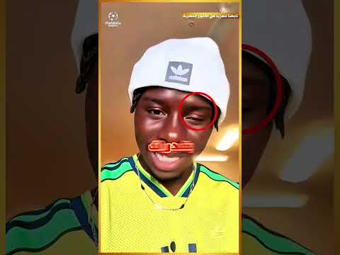 لاعب كرة قدم بعين واحده جورجي مينونغو لاعب منتخب بوركينا فاسو اجمل قصة ملهمة  باريدوليا