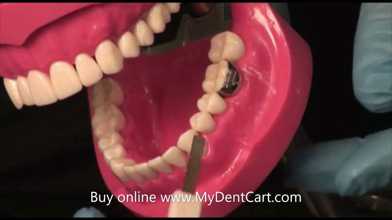 How to apply Preformed Molar Band orthodontics