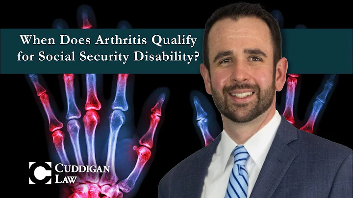 When Does Arthritis Qualify for Social Security Disability?