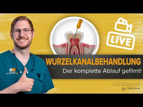 Wurzelkanalbehandlung am Modell