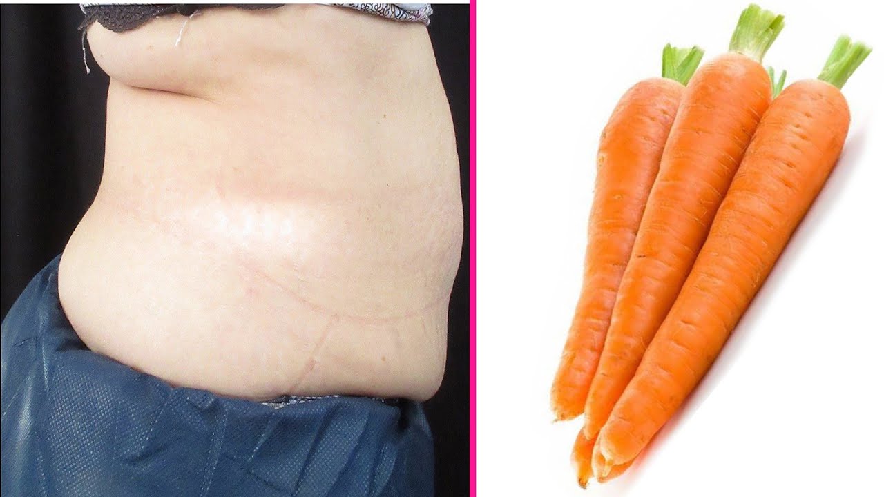How to Lose Weight Fast With Carrot ! NO Exercise NO DIET Loose Belly
