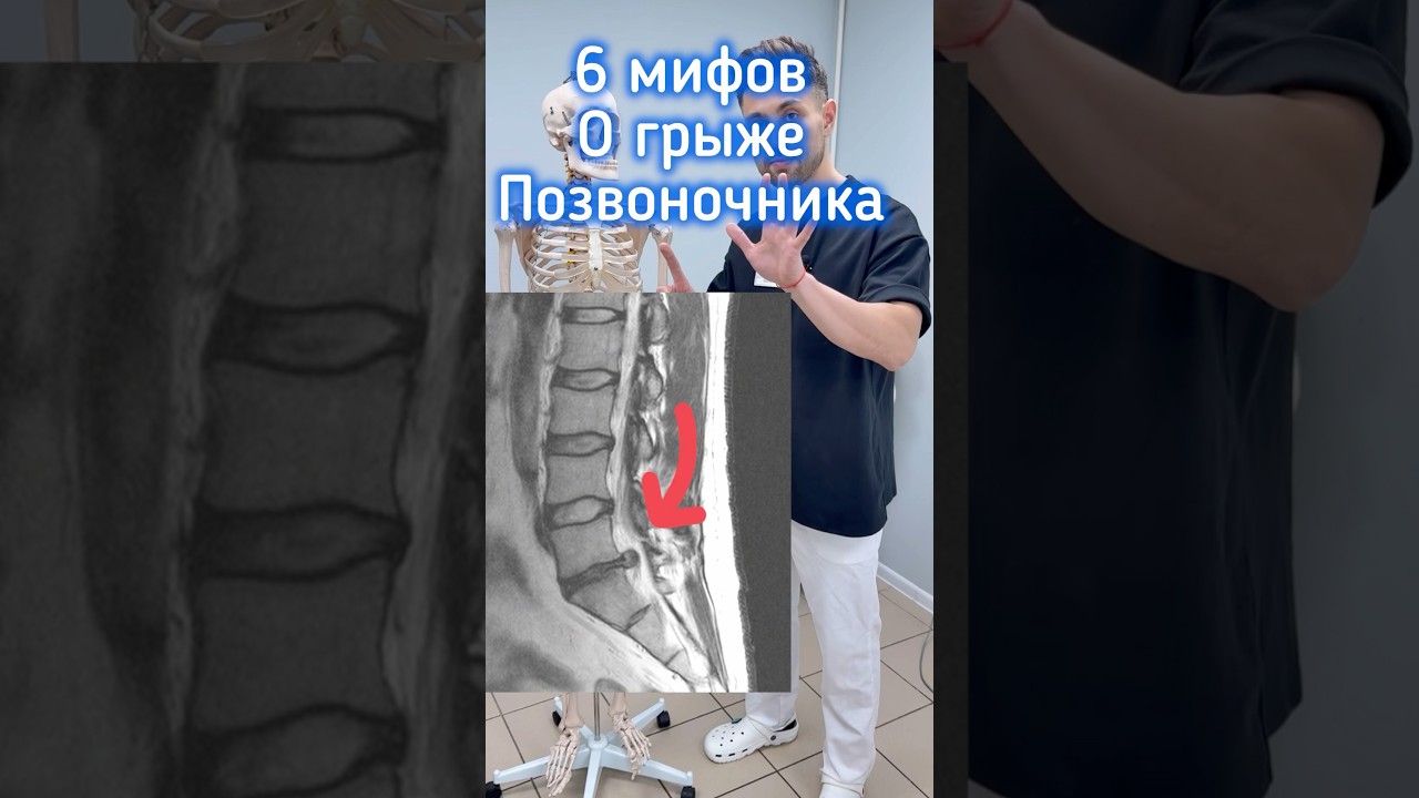 Правда о грыже позвоночника удивит тебя #позвоночник #г… — Transcript
