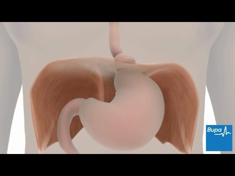 Video: Gastritis, Diaphragmatic Hernia - Folk Recipes