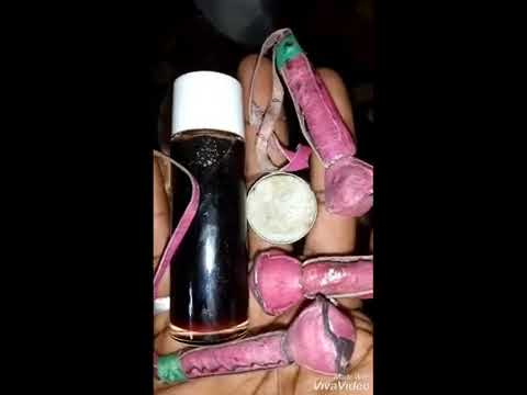 Kwallin Idonka Idona Na Farin Jini Da Mallaka Original Kayan MATA GYARAN Jiki Babangida Likitan Mata