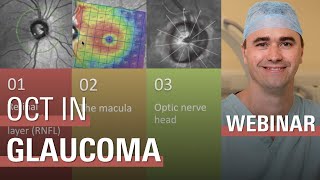 OCT in the Diagnosis and Management of Glaucoma