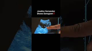 #joselinehernandez At Her Sonogram Appointment #ballisticbeats #pregnancyjourney