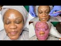 Microdermabrasion Anti-aging Facial | GlamByLiaLeigh