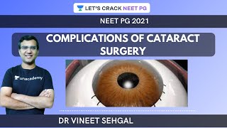 Complications of Cataract Surgery  |  NEET-PG 2021 | Vineet Sehgal