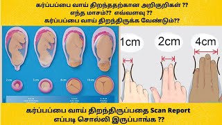 cervical dilation chart in tamil | Cervix dilation symptoms tamil | cervix dilation pain in tamil screenshot 4