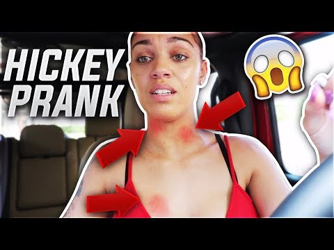 HICKEY PRANK ON HUSBAND!! **HE WAS PISSED**