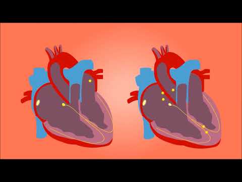 Video: Düşük IQ'nun nedeni nedir?