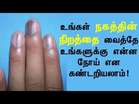 Nail|நகம்|உடல் ஆரோக்கியத்தை வெளிக்காட்டும் கண்ணாடி|நகத்தின் நிறத்தை வைத்து நோய்களைக் கண்டறியலாம்|