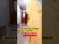 Both knee replacement surgery in Jaipur ~ 15 दिन बाद results