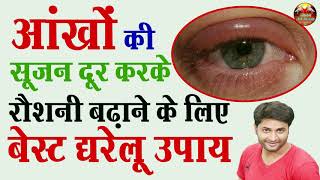 आँखों की सूजन दूर करके रौशनी बढ़ाने के लिए बेस्ट घरेलू उपाय! Swelling in eyes, Puff eyes treatment