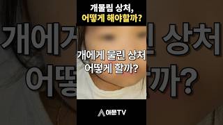 개에게 물린 상처는 어떻게 해야할까?(성형외과 얼굴 입가 개물림 상처 봉합 출혈 소독 마취 수면마취 어린이 병원 소아 흉터 레이저)[아문TV]