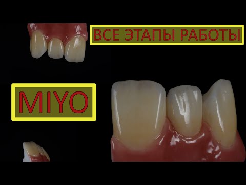 трейлер к видео, MIYO от А до Я. Цирконий в полную анатомию. exocad. Все этапы окрашивания.