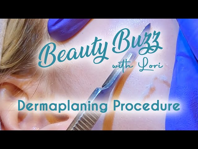 Beauty Buzz with Lori: Dermaplaning Procedure