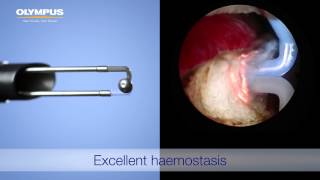 TURis 2.0 - Bipolar Resection